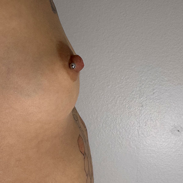 View 5